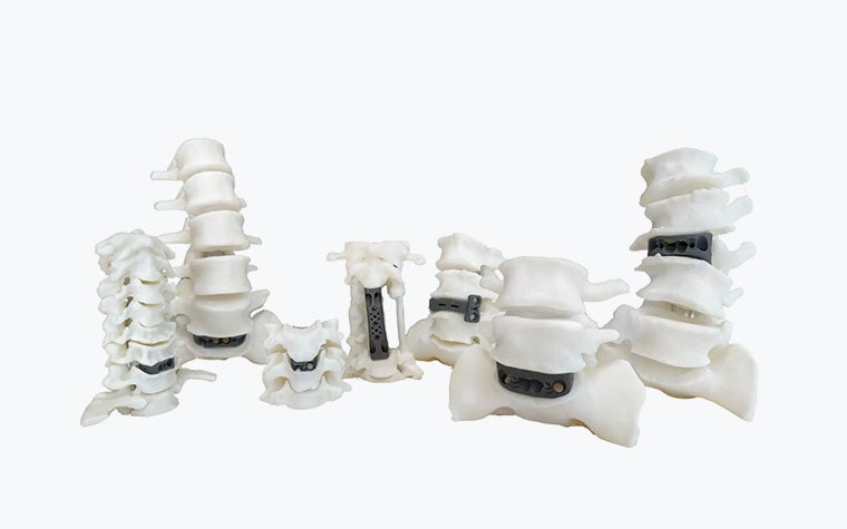 Each implant can be supplied with 3D-printed anatomical models or biomodels, enabling surgeons to perform procedures using accurate patient-specific replicas.