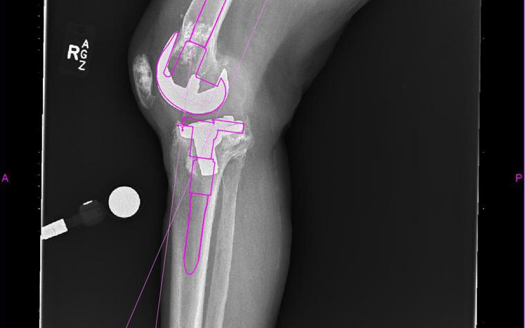 X-ray jinsiy aloqani tomosha qiling