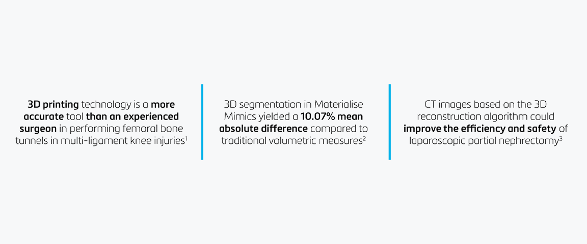 Three evidence-based statements on 3D surface modeling in surgical planning:

1. "3D printing technology is a more accurate tool than an experienced surgeon in performing femoral bone tunnels in multi-ligament knee injuries."
2. "3D segmentation in Materialise Mimics yielded a 10.07% mean absolute difference compared to traditional volumetric measures."
3. "CT images based on the 3D reconstruction algorithm could improve the efficiency and safety of laparoscopic partial nephrectomy."