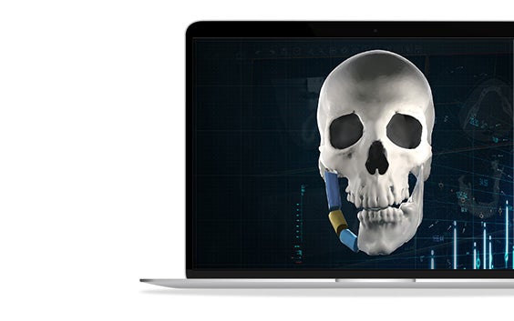 Digital image of a skull with the right side of the jaw segmented shown in a laptop screen