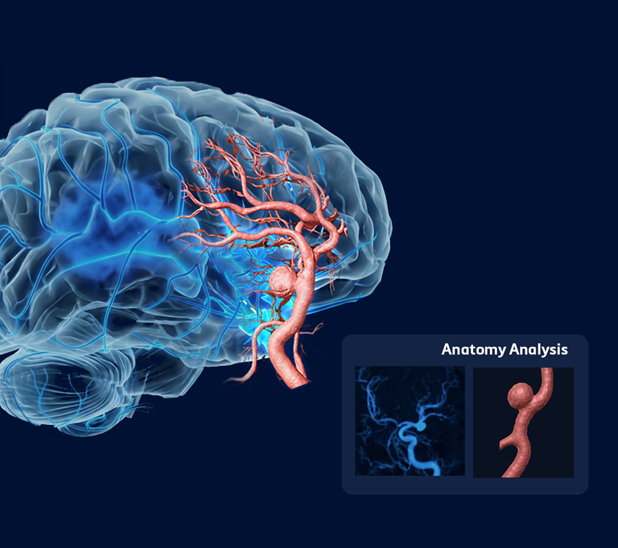 1. Segment and analyze patient anatomy