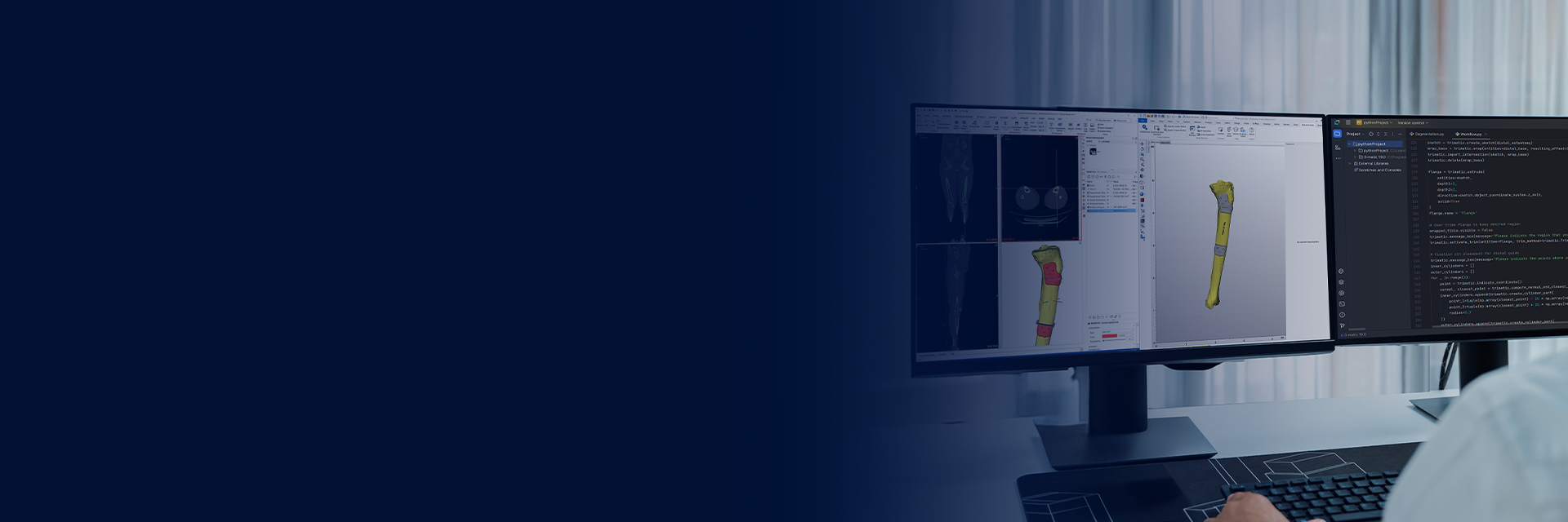 A view over the shoulder of a person working at a desk with two monitors: one showing a script in Python, and the other displaying patient scans, segmented anatomy, and a personalized surgical guide design in Materialise Mimics