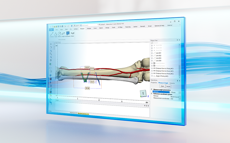 Materialise Mimics software displayed a cutting guide design on a patient bone with blue swirly lines in the background
