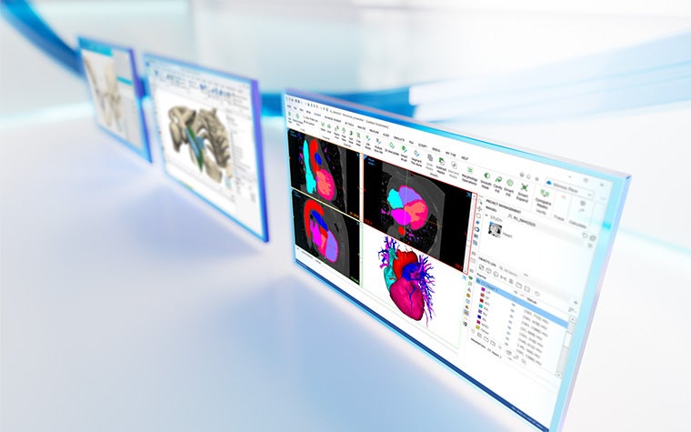 Three screens showing patient anatomy within software from the Materialise Mimics platform on a white reflective background with blue lines