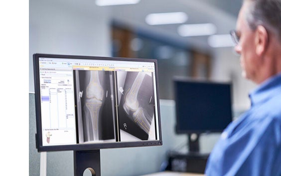 How to Plan a Total Hip Arthroplasty in Less than 60 Seconds 