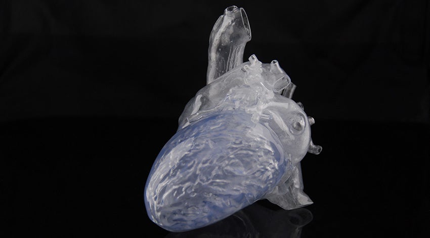 3D-printed, transparent heart model 