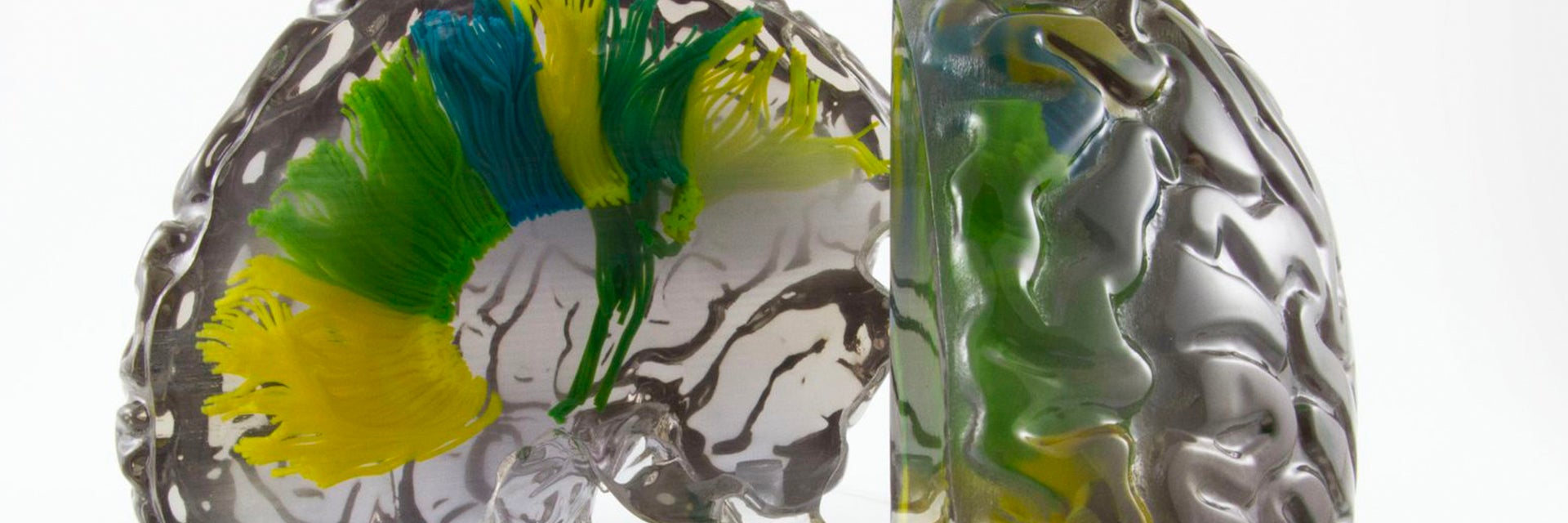 Brain model printed using PolyJet  