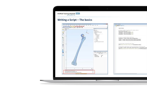 Scriptmed Tool Webinar: Automatically Fitting Devices and Performing Measurements