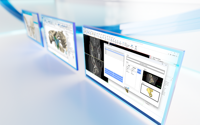 Trois écrans montrant l'anatomie du patient dans le logiciel de la plateforme Materialise Mimics sur un fond blanc réfléchissant avec des lignes bleues.