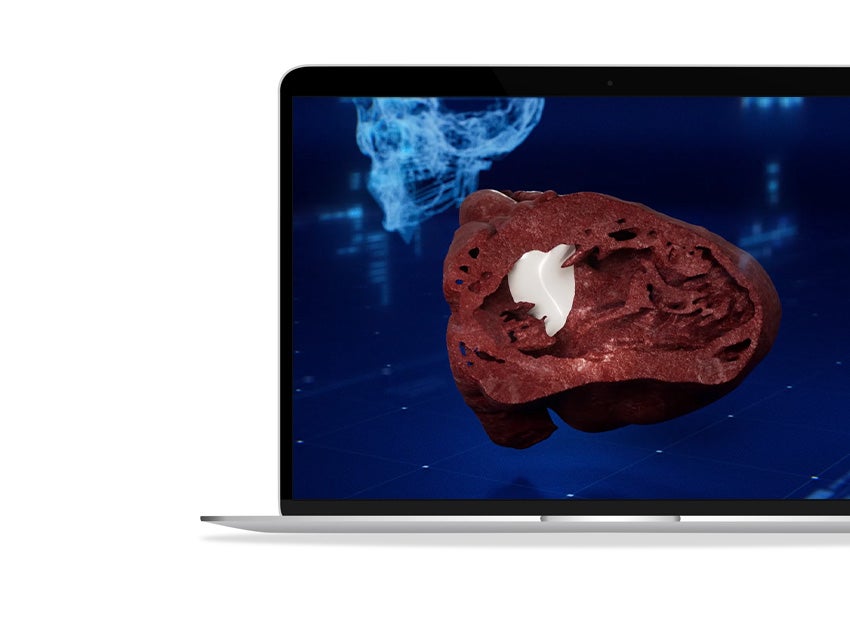Split-section view of a virtual 3D anatomical heart model shown on a laptop screen.