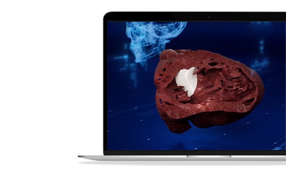 Split-section view of a virtual 3D anatomical heart model shown on a laptop screen.