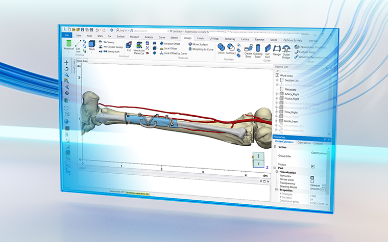 Materialise Mimics software displayed a cutting guide design on a patient bone with blue swirly lines in the background