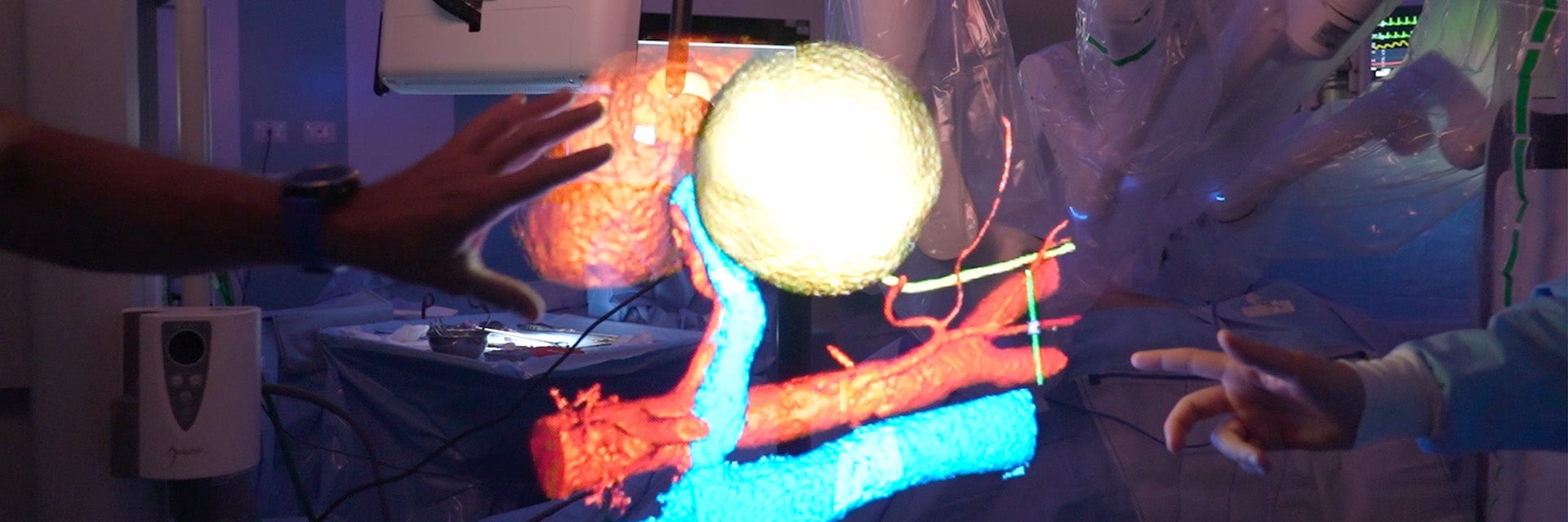 A holographic 3D medical visualization showing anatomical structures in red, blue, and yellow, with two people’s hands interacting with the floating image in a surgical setting.