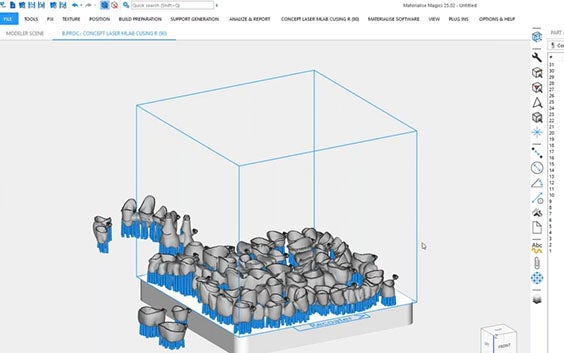 4 Common 3D Printing Challenges for Dental Labs: Why Automation Is the Solution