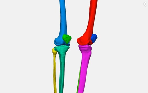 Versatility in Mimics: 3 Ways to Segment Bones