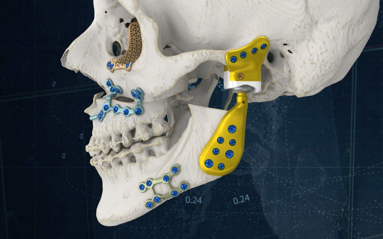【裁断済み】2023 Dental Implantology 1-6号 セット 116683-14744833.webp