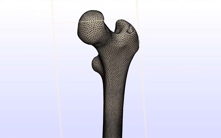 How to Prepare a Bone Model for FEA