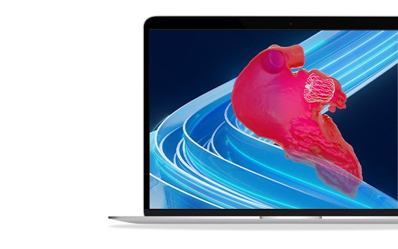 ssm-cardiovascular-solutions-mimics-laao-left-atrial-appendage-occlusion.jpg
