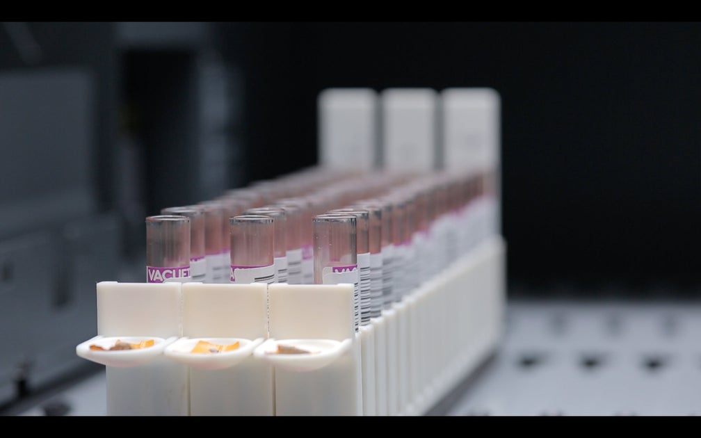 Tests to diagnose blood disorders and blood cancers DKMS