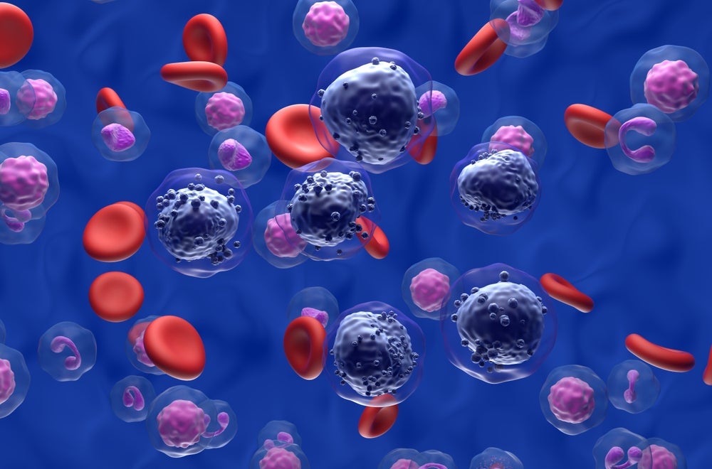 3d illustration of acute myeloid leukaemia cells