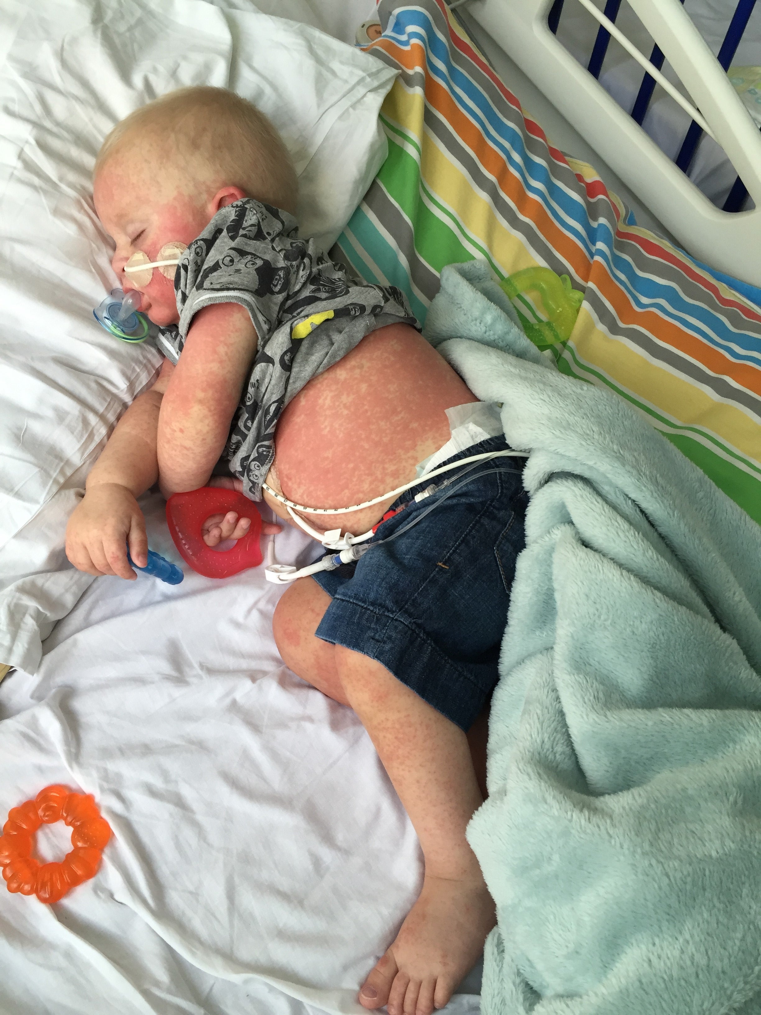 Alfie in hospital during his treatment