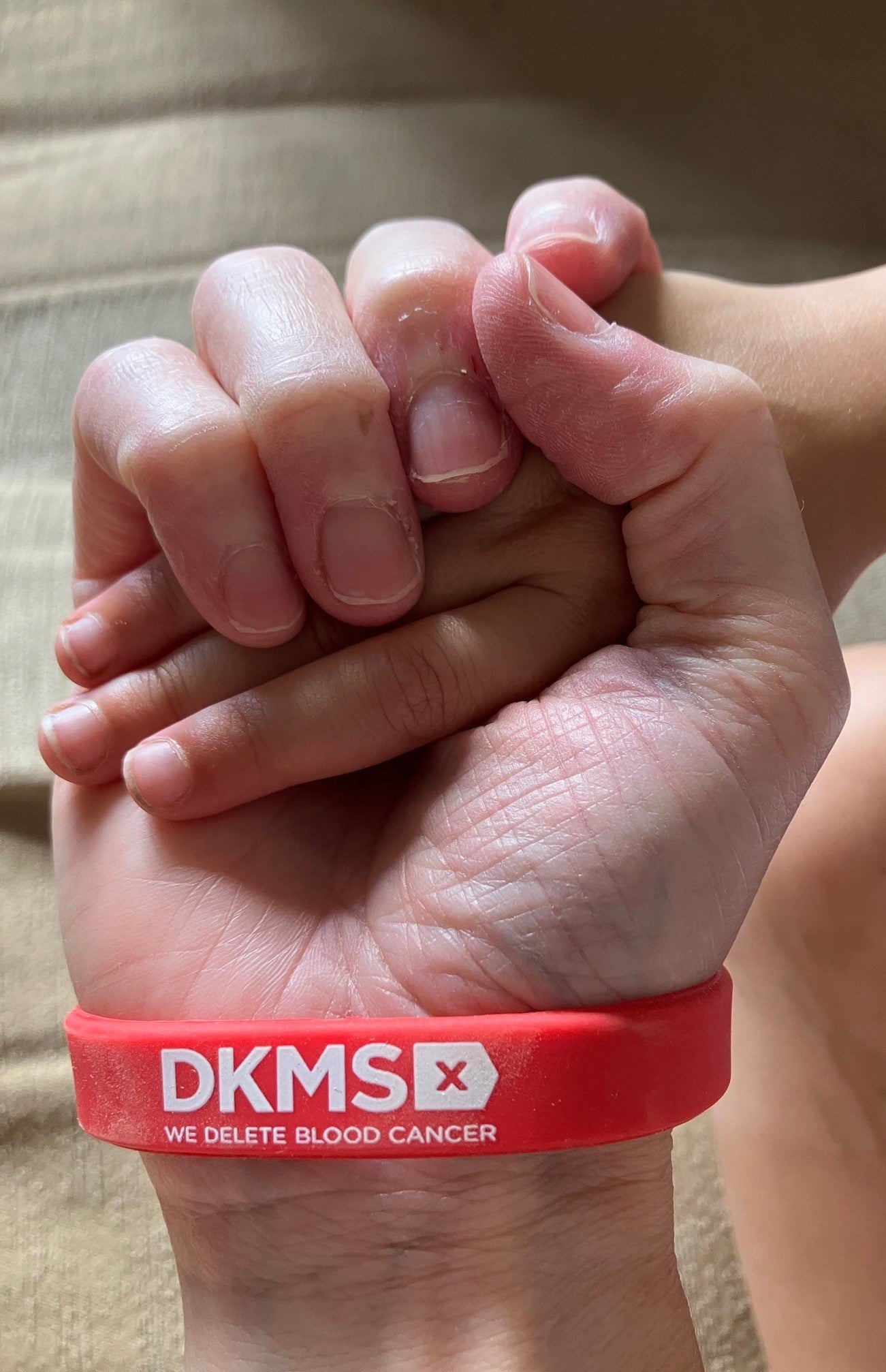 Holding hands with DKMS band.