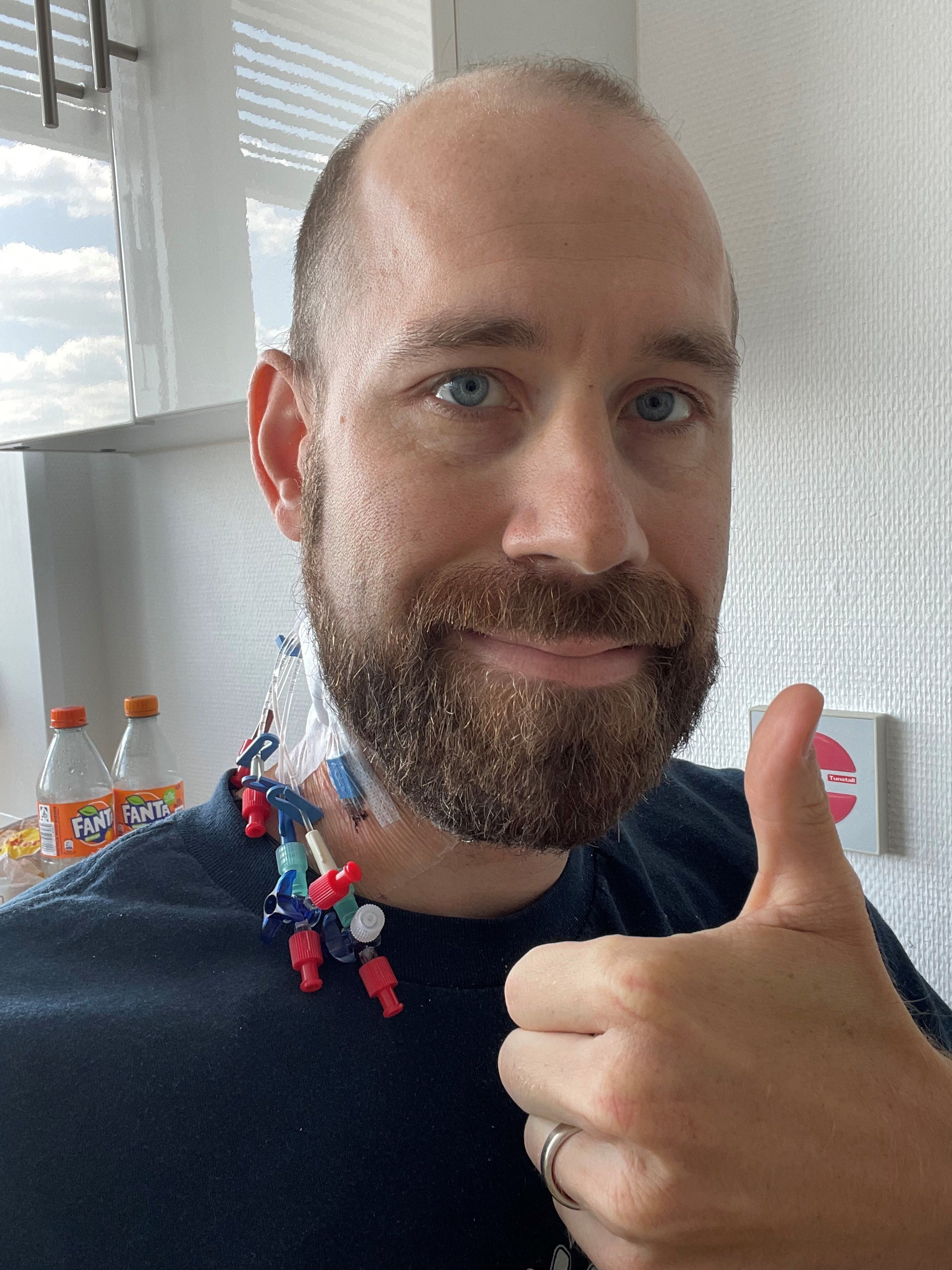 Timm showing thumbs up.