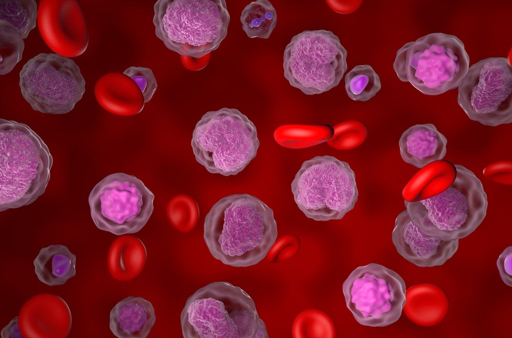 3D illustration of lymphoma 
