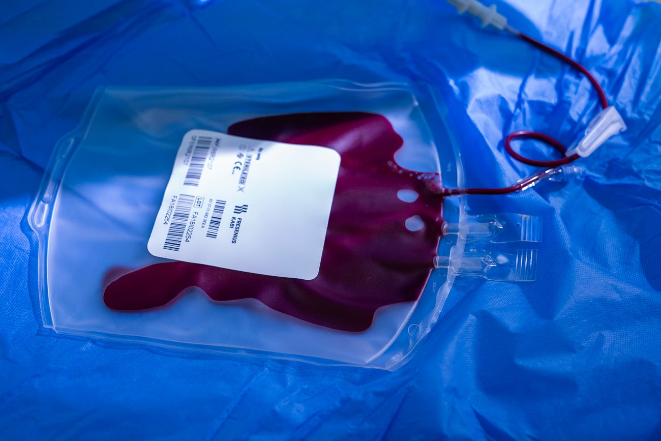 worek z życiem, komórki macierzyste