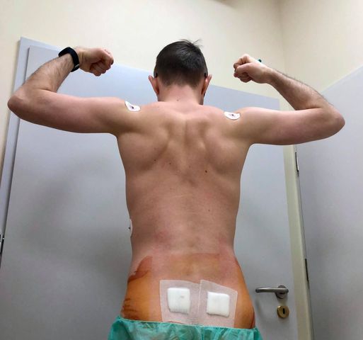 Łukasz Lewandowski - Dawca szpiku