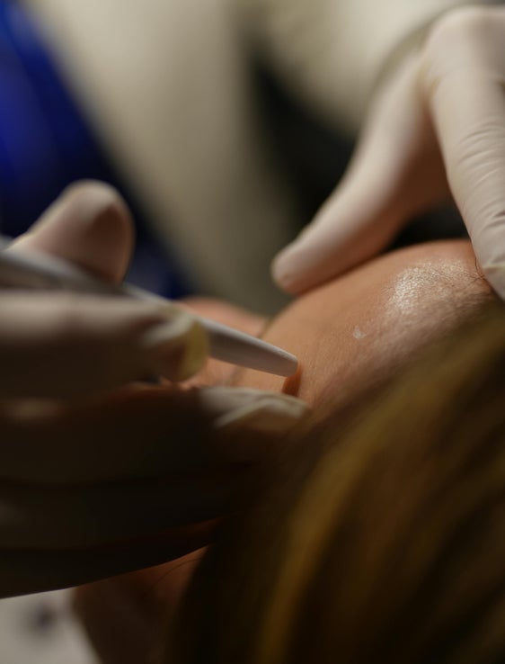 In futuro saranno disponibili molti più posti per aspiranti dermatologi e dermatologhe in Alto Adige. Lo ha deciso la Giunta provinciale. (Foto: USP/Pexels. La foto può essere utilizzata solo in relazione a questo comunicato stampa).