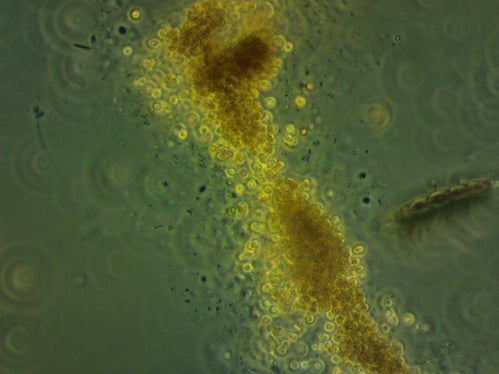 I cianobatteri al microscopio: questi organismi possono produrre tossine pericolose per l'uomo e gli animali e possono causare irritazioni cutanee o problemi gastrointestinali. (Foto: ASP/Laboratorio Biologico)