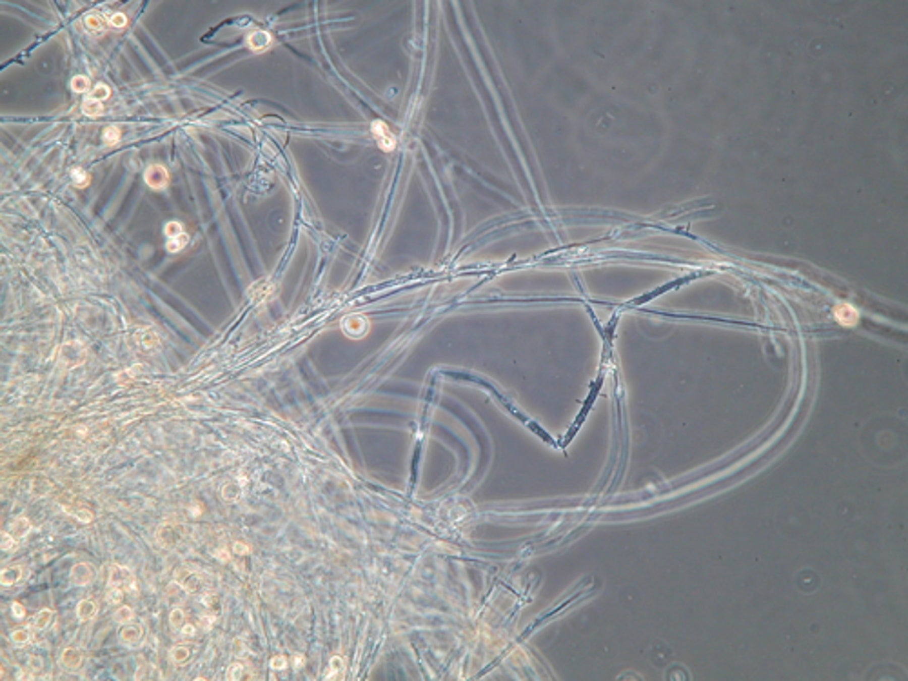 Biofilm al microscopio. L'APPA ha previsto ulteriori 300 analisi fino a fine 2002.  (Foto: Agenzia provinciale per l’ambiente e la tutela del clima, E. Bucher, 2019)