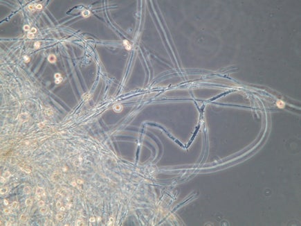 Biofilm al microscopio. L'APPA ha previsto ulteriori 300 analisi fino a fine 2002.  (Foto: Agenzia provinciale per l’ambiente e la tutela del clima, E. Bucher, 2019)