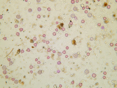 Un campione con minuscoli granuli di polline di colore rosa: in alcuni giorni vengono contati in un singolo campione oltre 5.000 granuli di polline. (Foto: Agenzia provinciale per l'ambiente e la tutela del clima)