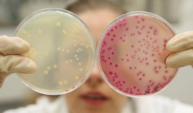 Laborante laat twee petrischaaltjes zien met verschillende bacteriekweken