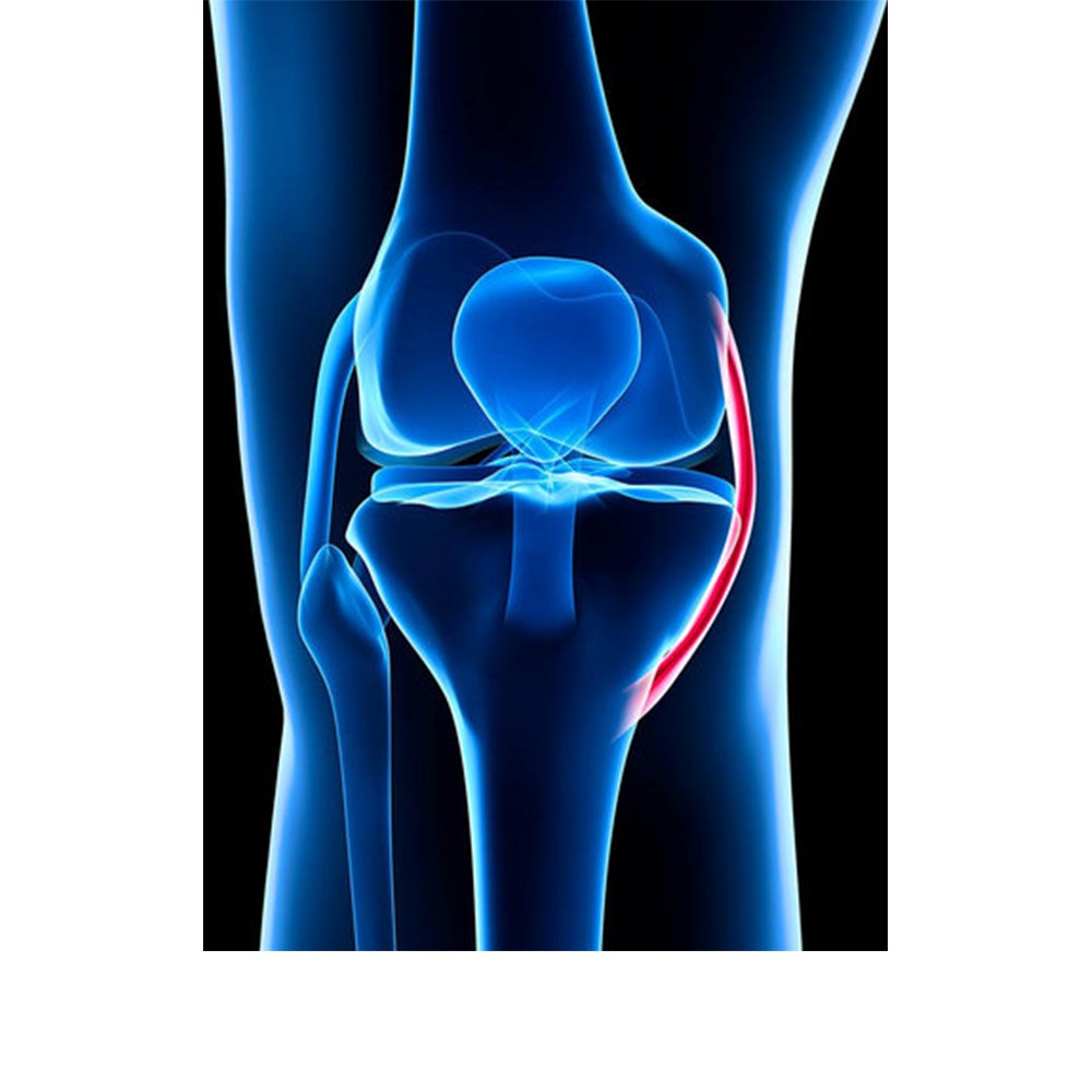 Grafik Bänder im knie