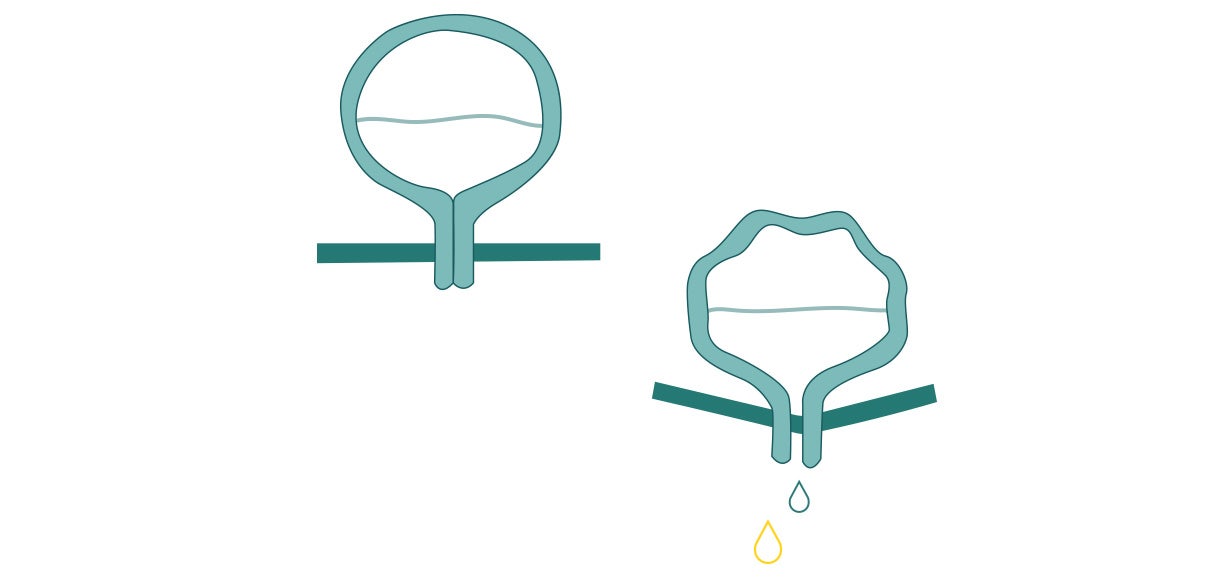 Illustr bladder