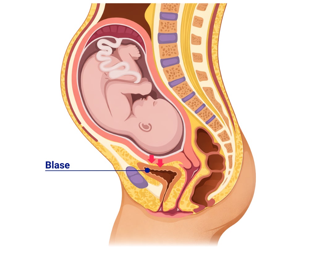 Grafik eines Fötus im Bauch