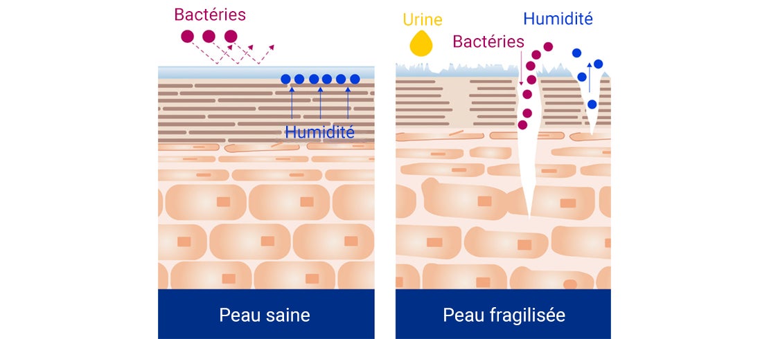 Graphique peau saine - peau affaiblie