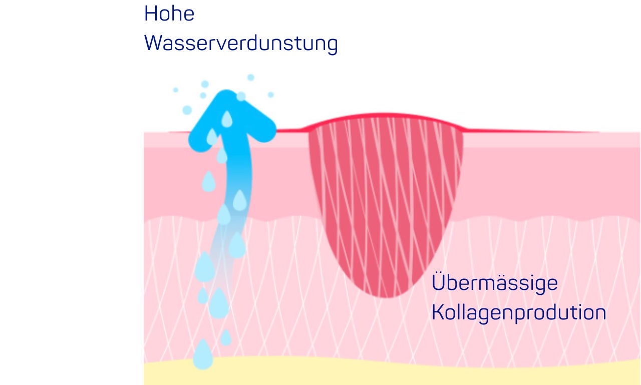 DP Effect Wasserverdunstung 1280x769