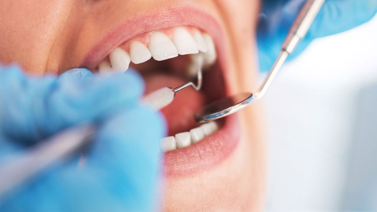 Dentist examining teeth close up