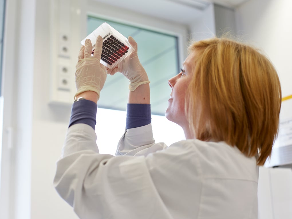 In the DKMS Life Science Lab, an employee checks a prepared blood sample panel for the correct fill level. In the DKMS Life Science Lab, an employee checks a prepared blood sample panel for the correct fill level.