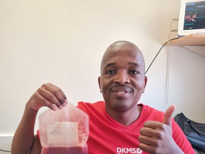 Kwazi donating stem cells Kwazi donating stem cells