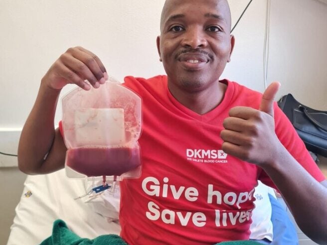 Kwazi donating stem cells Kwazi donating stem cells