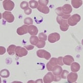 Trypanosoma cruzi in blood smear