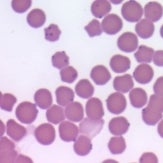 Mycoplasma haemofelis infecting red blood cells