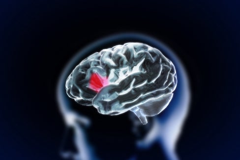 Schlaganfall - jede Minute zählt (Foto 123rf)