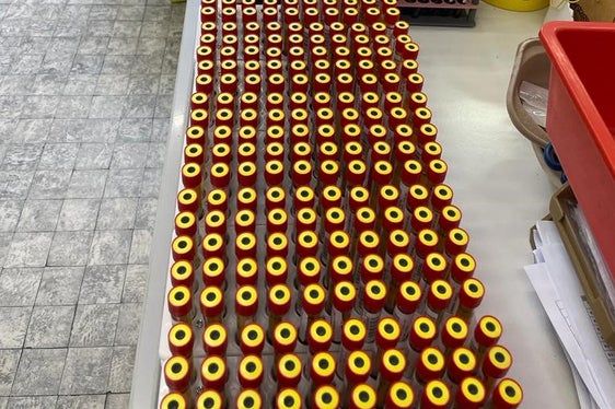 Bis zum 28.03.2023 wurden im Zuge des Hepatitis-C-Screenings 11.666 Proben analysiert