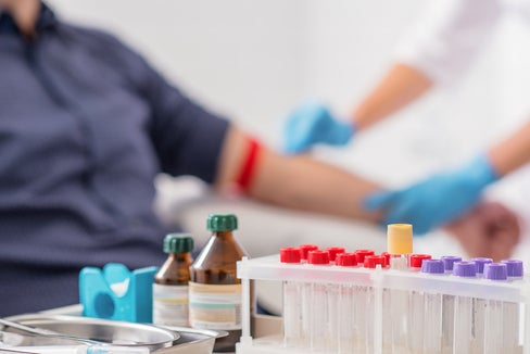 Neuerungen bei Absagen von Laborterminen ab November (Foto: 123rf)